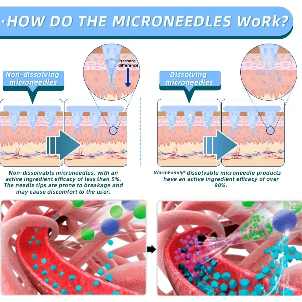 【WarmFamily® Official Store】Tirzepatide Nano Microneedle Patch 🇺🇸👨‍⚕️（Zero Pain, 24/7 Release | Lose 20lbs FAST | 90% Sugar Drop | ）