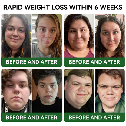WarmFamily® 𝗚𝗟𝗣-𝟭 Slimming & Health Boost Drops | Food-grade fat burner🔥