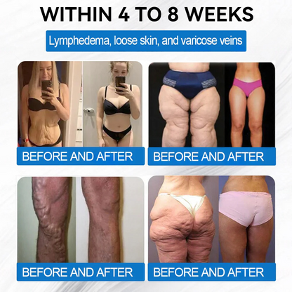 Clinically proven | WarmFamily®✅ SMGT-GLP-1 Nano Microneedle Patch with Collagen & Matrixyl 3000 | Obesity,Cardiovascular Diseas, Diabetes, Sleep Apnea, Joint Problems and More"