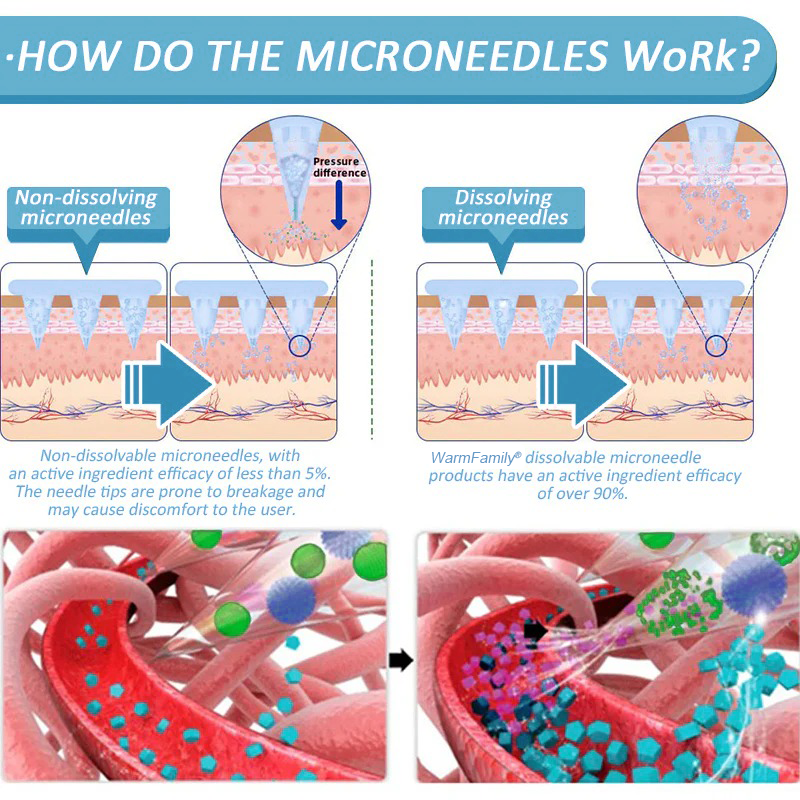 WarmFamily® SMGT-GLP-1 Nano Microneedle Patch with Collagen & Matrixyl 3000 ✅ | Clinically Proven for Weight Loss, Cardiovascular Health, Diabetes, and More Health Issues, Doctor Recommended👨‍⚕️👨‍⚕️