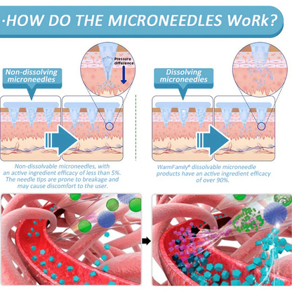 WarmFamily® SMGT-GLP-1 Nano Microneedle Patch with Collagen & Matrixyl 3000 ✅ | Clinically Proven for Weight Loss, Cardiovascular Health, Diabetes, and More Health Issues, Doctor Recommended👨‍⚕️👨‍⚕️
